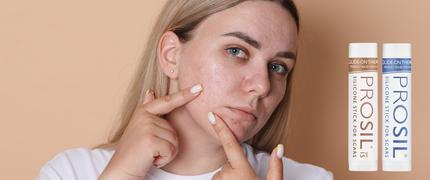 15 % studentrabatt på ProSil® hos Bonimedics