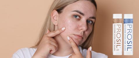 15 % studentrabatt på ProSil® hos Bonimedics